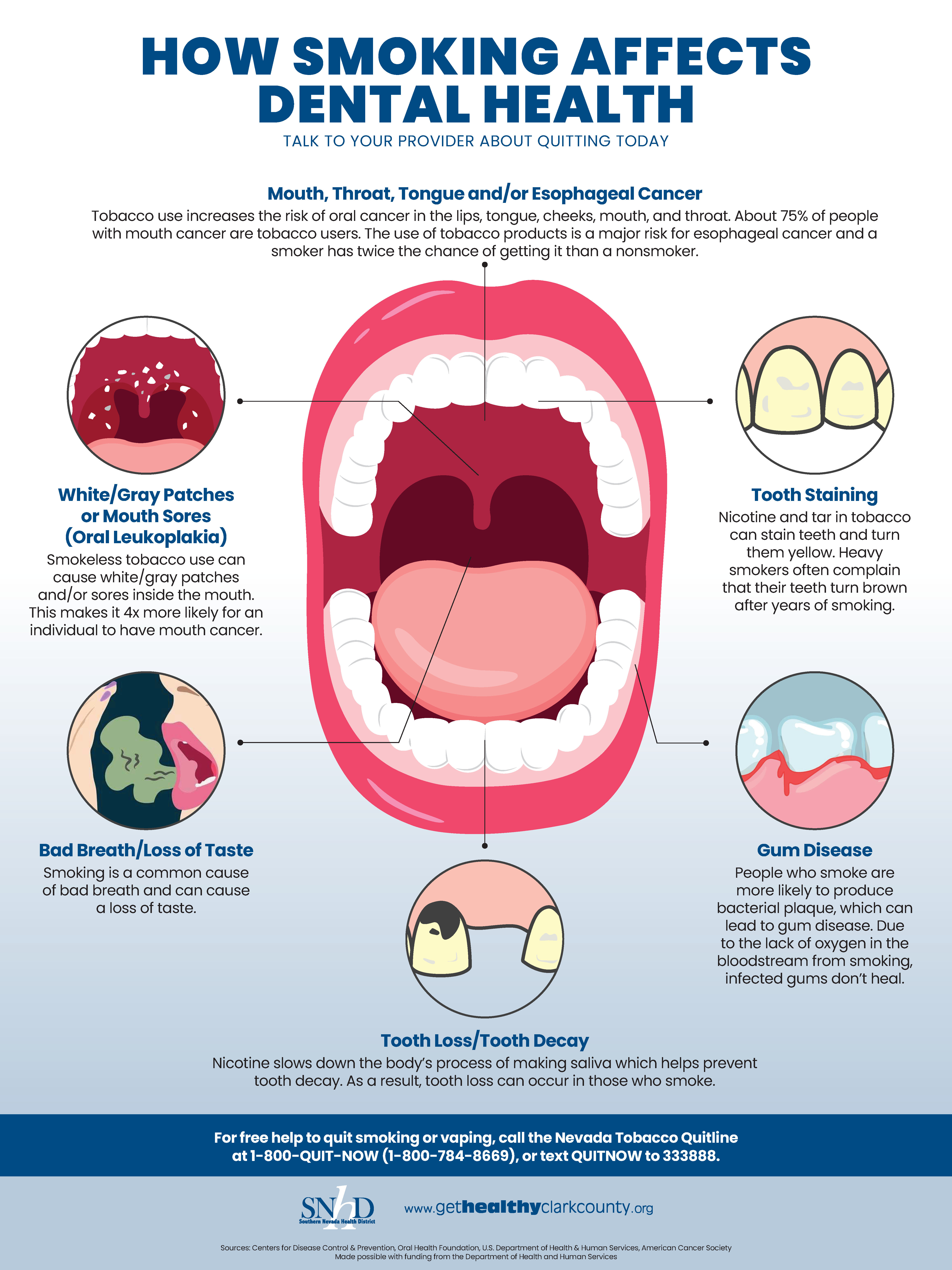 How Smoking Affects Dental Health Poster - Get Healthy Clark County